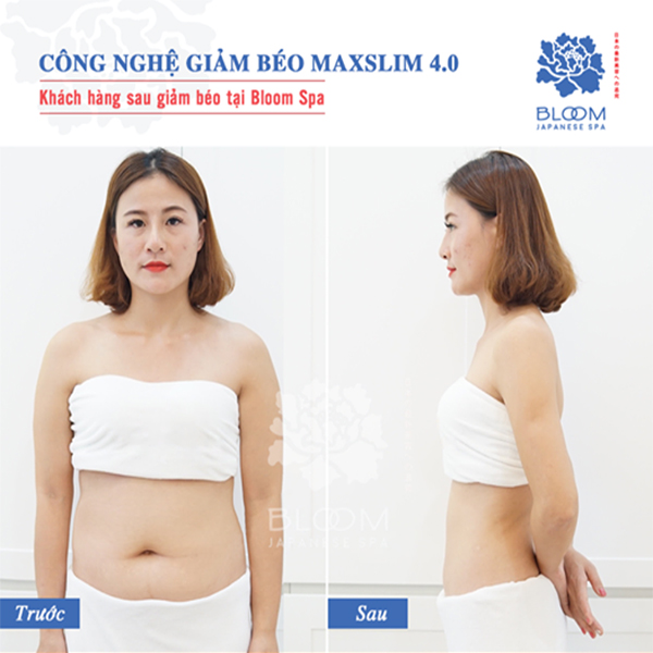 Giảm béo dưỡng sinh Fuji vùng lưng - 15B