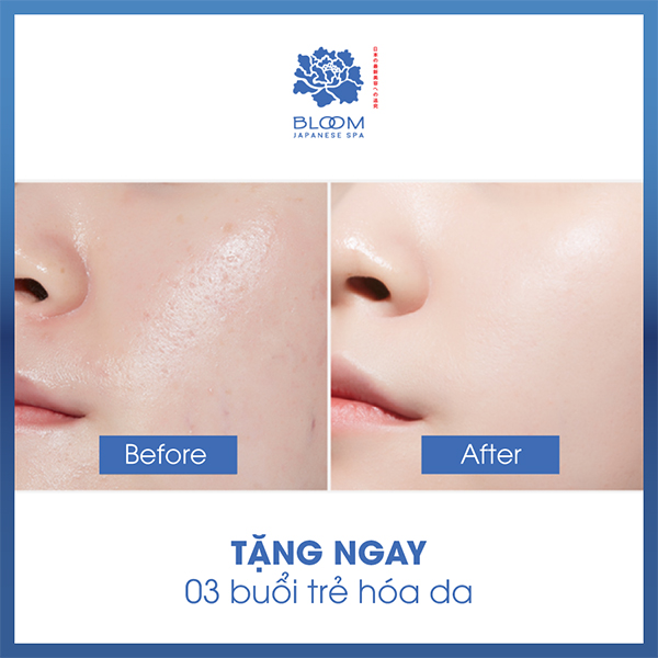 Trẻ ngay 3 tuổi với liệu pháp Forever Young Face - 5B