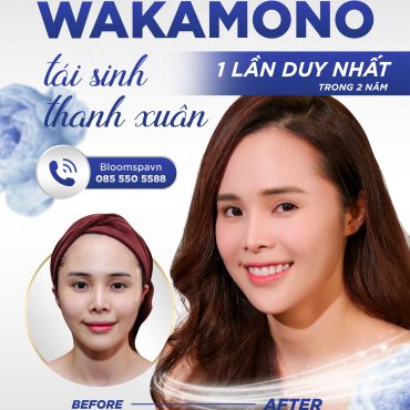 WAKAMONO và câu chuyện “TÁI SINH THANH XUÂN” cho hàng nghìn khách hàng Việt